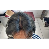 peruca de cabelo natural para homem no Alto de Pinheiros