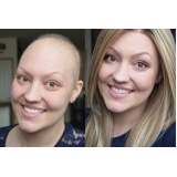 perucas femininas para quimioterapia em Hortolândia