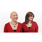 venda de peruca feminina para quimioterapia em Suzano